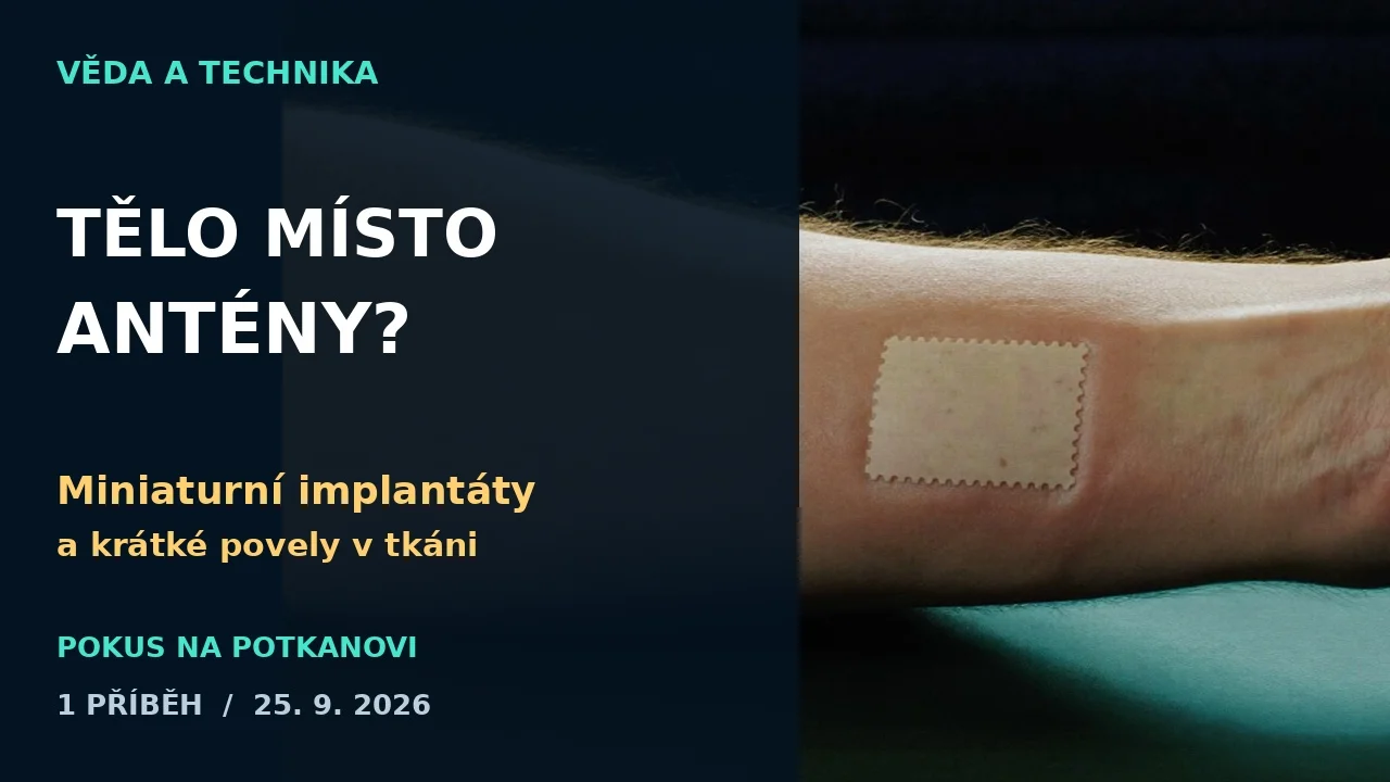 Náhled videa: Tělo místo antény: co skutečně předvedla síť miniaturních implantátů